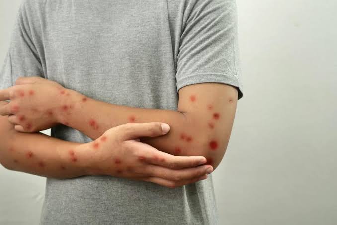 عوارض مصرف مخدر شیشه